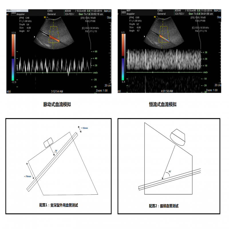 多普勒超聲血流型模擬器